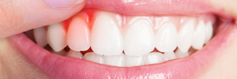 又上火又怕冷？上熱下寒、水火不濟(jì)，教你調(diào)回來(lái)！