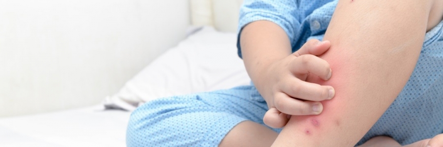 學古人這樣驅蚊，從此不再“蚊”風喪膽！