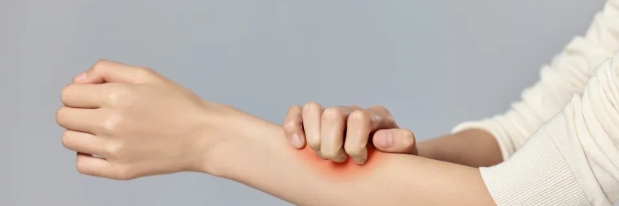 濕疹、瘙癢、蕁麻疹……患皮膚病，也許是好事！